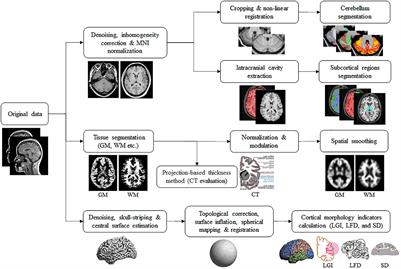 Machine Learning Models for Diagnosis of Parkinson’s Disease Using Multiple Structural Magnetic Resonance Imaging Features